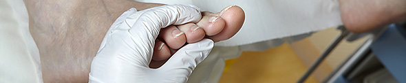 Foot in plaster cast